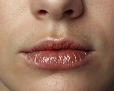 Dry Lips: 9 Excellent Natural Remedies
