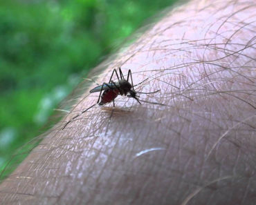 Mosquito Bites: 14 Effective Natural Treatments