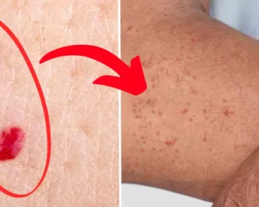 11 Reasons and Potential Dangers Behind Red Dots on Your Skin