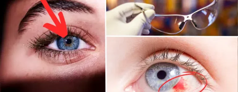 Doctors Reveal Everyday Tasks That Could Be Damaging Your Eyesight Without You Knowing