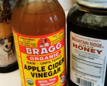 Honey & Apple Cider Vinegar: The Powerful Combination to Cleanse Your Colon and Lower Blood Pressure