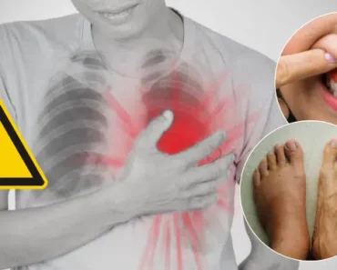 10 Surprising and Strange Signs of Heart Disease You Need to Know About