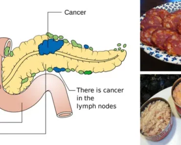 8 Cancer-Linked Foods You Should Never Put in Your Mouth Again