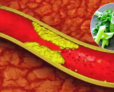 Take 4 Tablespoons of This Drink Every Morning: Treat Clogged Arteries, Cholesterol, and High Blood Pressure!