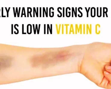 9 Early Warning Signs You’re Running Low on Vitamin C