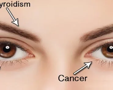 9 Things Your Eyes Are Telling You About Your Health: Here’s What to Look For