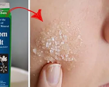 Therapist Reveals 10 Common Health Problems That Can Be Treated Using Epsom Salt