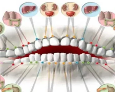 Each Tooth Is Associated With an Organ in the Body – Pain in Each Tooth Can Predict Problems in Certain Organs