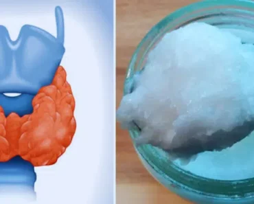 Eat 1 Tablespoon of Coconut Oil a Day and THIS Will Happen to Your Thyroid