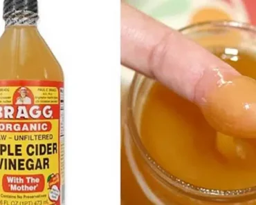 How to Take Apple Cider Vinegar to Help Lose Weight and Reduce High Blood Pressure