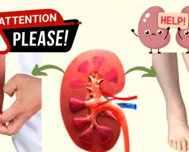 If Your Kidney Is in Danger, the Body Will Give You These 8 Warning Signs