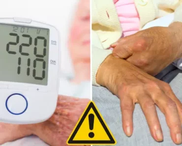 Experts Release Newest Guidelines to Prevent Stroke, the Nation’s 4th Biggest Killer