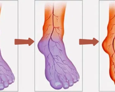 Poor Blood Circulation, Cold Hands, and Legs? Expert Therapist Shares 3 Remedies and 7 Tips to Solve This Problem