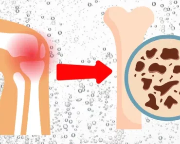 This Common Beverage is Slowly Destroying Your Bones, and You’re Probably Drinking It