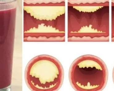 This Juice Unclogs Arteries and Protects Against Heart Disease