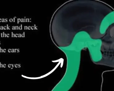 This Vitamin Deficiency Can Cause Terrible Headaches and Migraines: Here’s How to Fix It