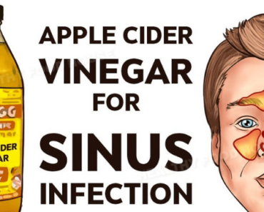 How to Treat a Sinus Infection Within Minutes with Apple Cider Vinegar