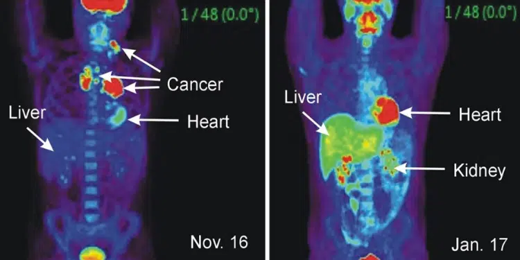 10 Early Warning Signs That Cancer May Be Growing in Your Body