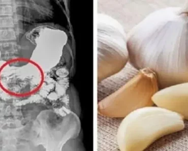 Here’s What Happens if You Eat Raw Garlic on an Empty Stomach Every Day