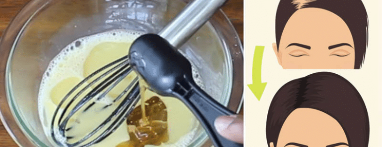 Mix These 3 Ingredients to Regrow Thick, Strong Hair in No Time!