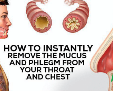 How to Naturally Get Rid of Phlegm and Mucus in Chest & Throat