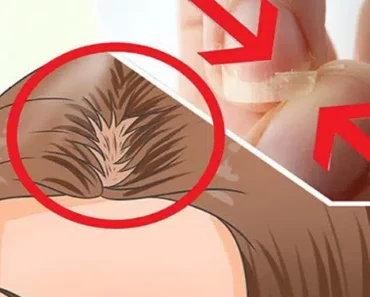 Eat This if You Have Brittle Nails, Thinning Hair, or if You’re Not Sleeping Well