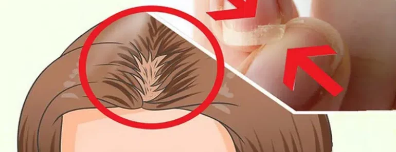 Eat This if You Have Brittle Nails, Thinning Hair, or if You’re Not Sleeping Well