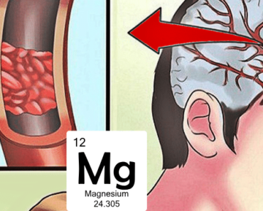 13 Warning Signs That You Immediately Need Magnesium and How to Get It