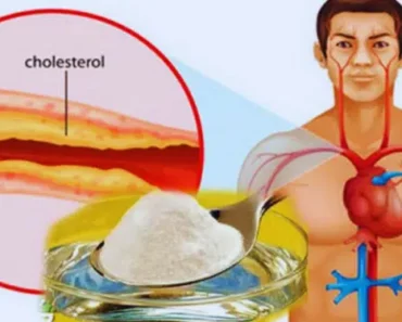 The Best Home Medicine Against Cholesterol and High Blood Pressure