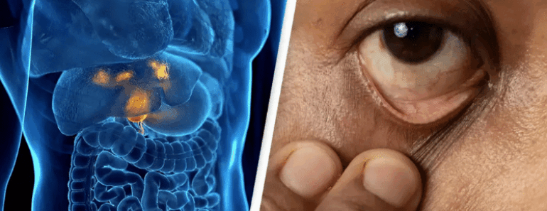 Little-Known Form of Cancer Surges in Young People—and There’s One Alarming Reason Why