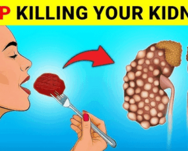 7 Early Signs Your Kidneys Are Failing (And How to Prevent It)