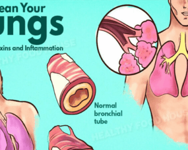 How to Get Rid of Phlegm and Mucus in Your Chest & Throat (Instant Results)