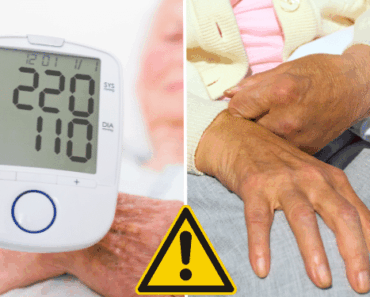 Stroke Is the #4 Killer — These New Guidelines Could Change That