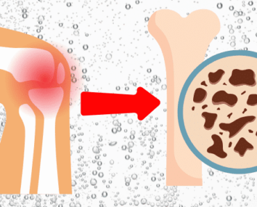 This Common Beverage is Slowly Destroying Your Bones, and You’re Probably Drinking It