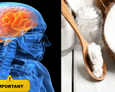 This Man Ate 2 Tablespoons of Coconut Oil Twice a Day, and This is What Happened to His Brain