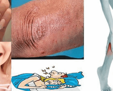 When the Body Asks for Help – 13 Important Signs You Cannot Ignore