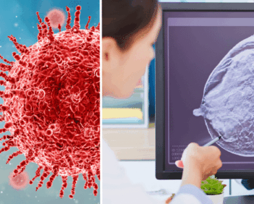 Primary Causes of Breast Cancer Need To Know Primary Causes of Breast Cancer Need To Know