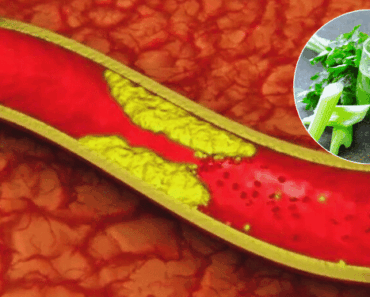 New Natural Remedy: 4 Tablespoons a Day May Help Lower Cholesterol and Support Heart Health