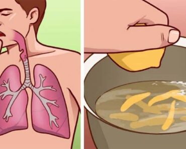 10 Home Remedies to Help With Bronchitis and Painful Coughing Attacks
