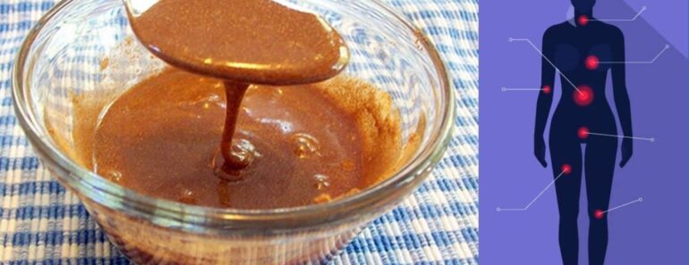 Cinnamon And Honey Fights Off Colds, Flu, Acne, Weight Loss And More